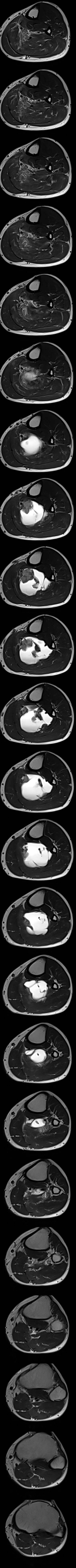 Delhi MRI · axial T2