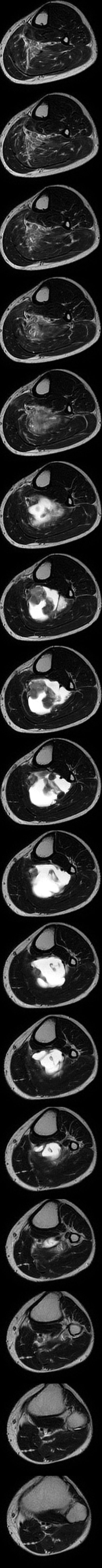 Kathmandu MRI · axial T2